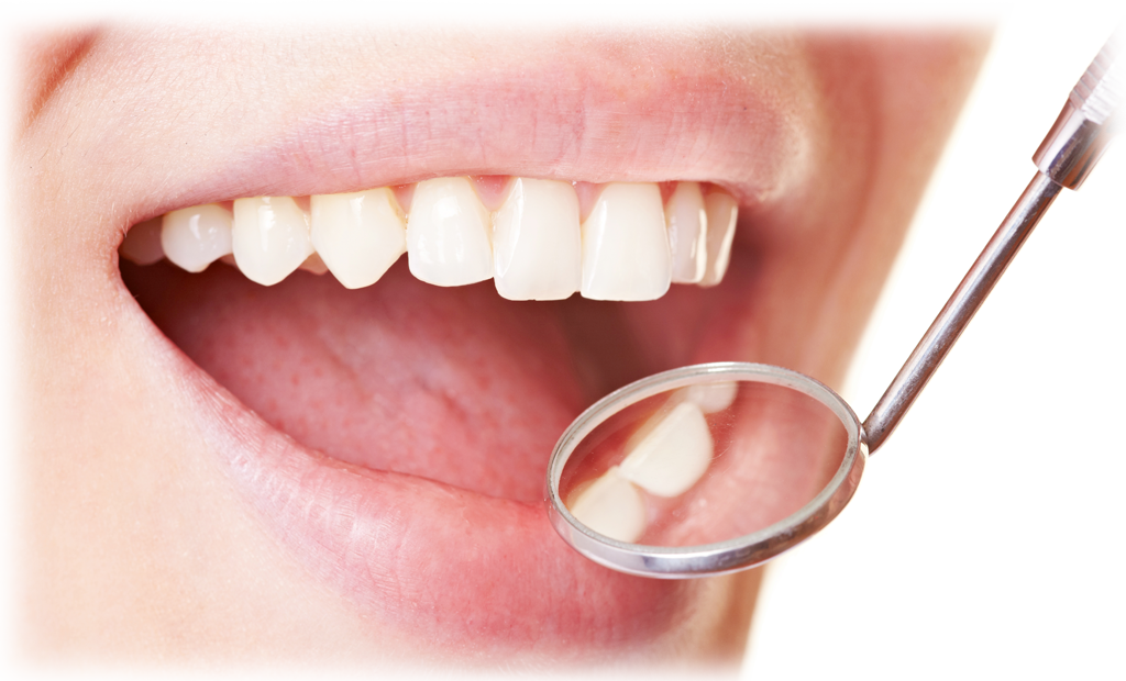 むし歯治療の特徴