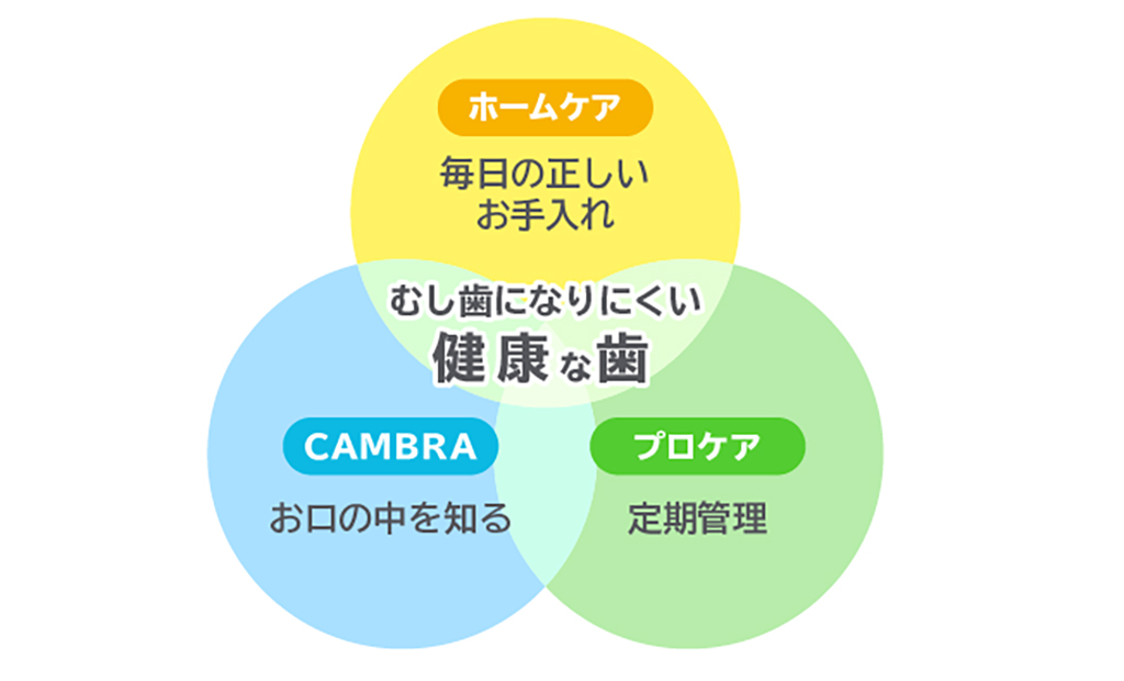 歯を失ってしまう原因の1つが「むし歯をくり返すこと」