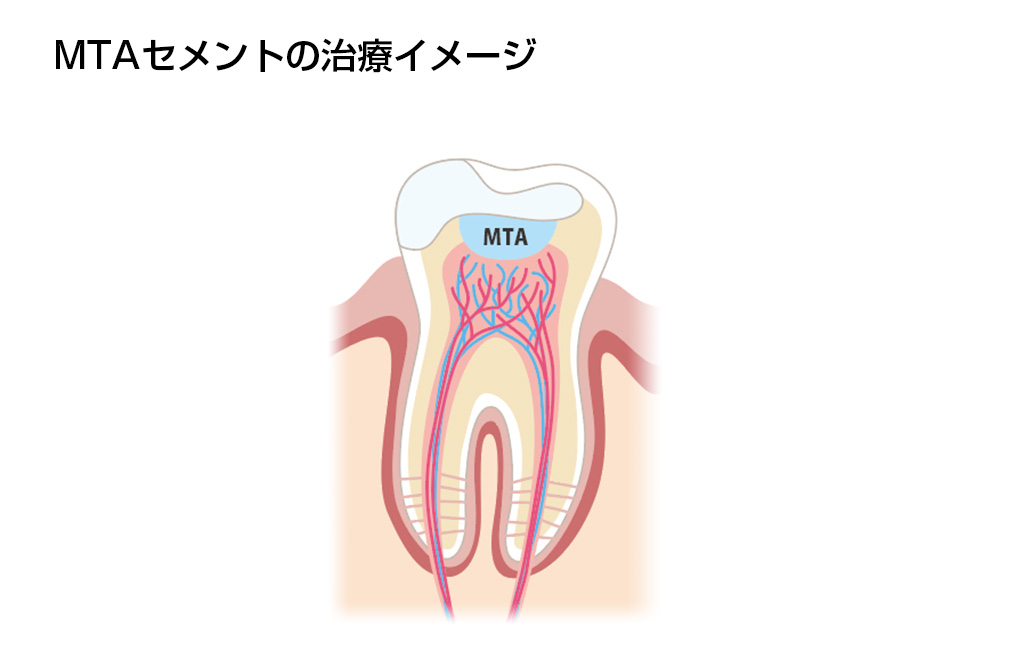 検知薬