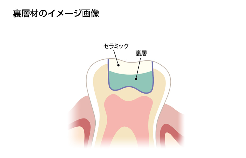 裏層材の使用